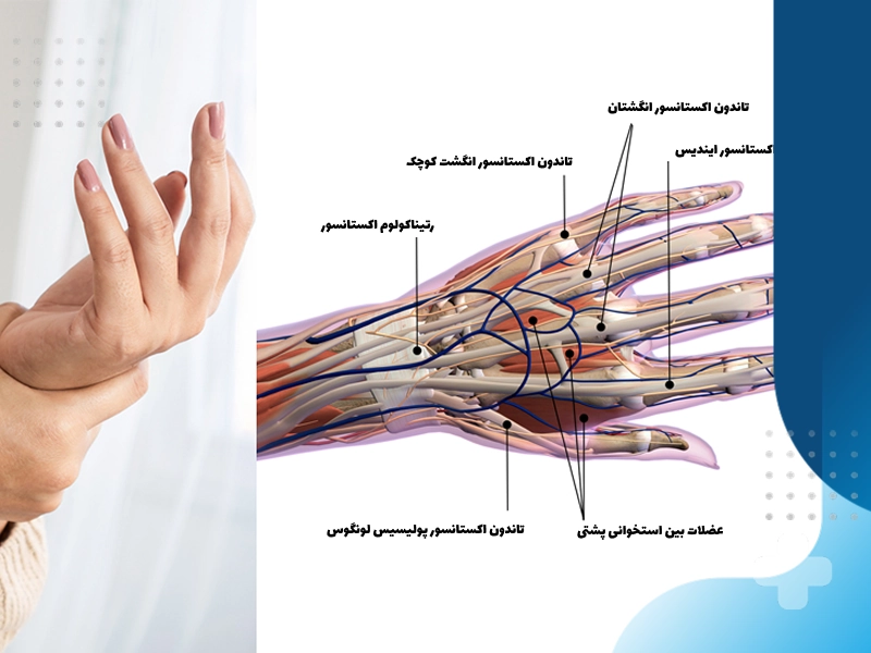 تشخیص سندروم تونل کارپال