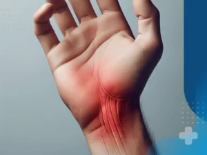 سندروم تونل کارپال با فیزیوتراپی