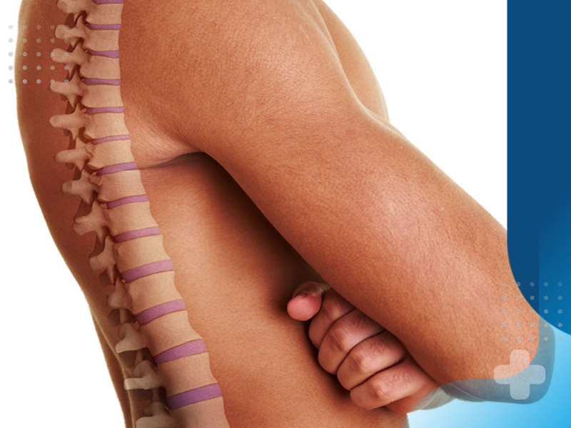 درمان دیسک کمر