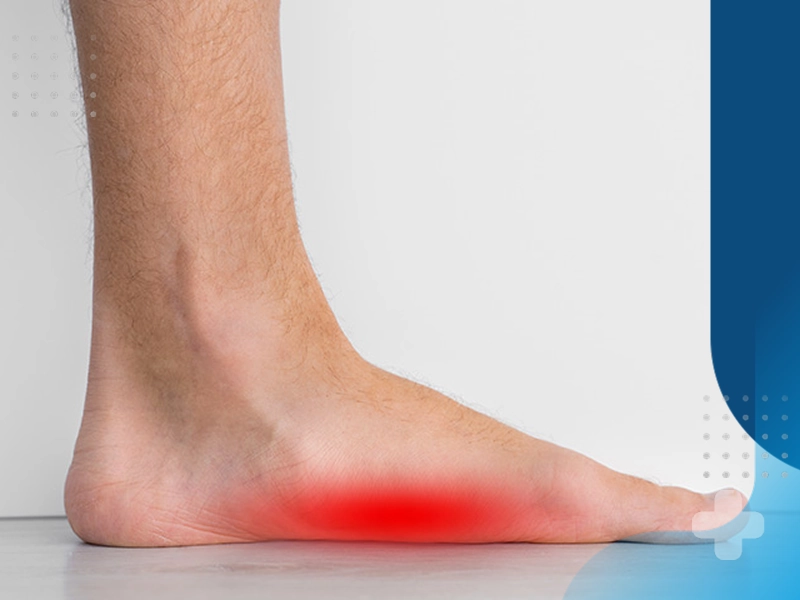 بهترین روش های درمان صافی کف پا