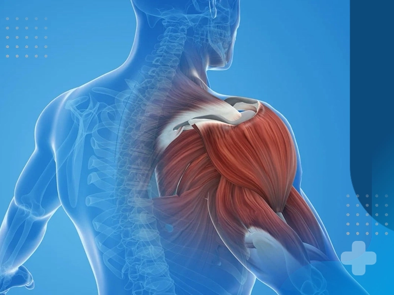 تأثیر فیزیوتراپی در درمان درد های مزمن مفصلی